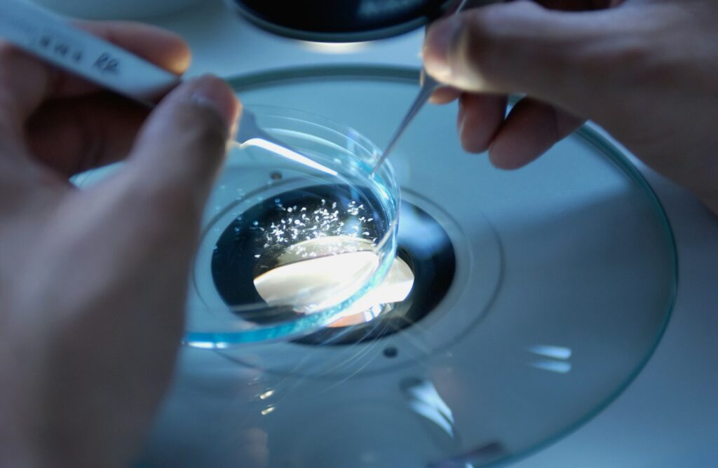 Laboratorijski rad pinsetom u staklenoj Petrijevoj posudi, kao kod vantjelesne oplodnje